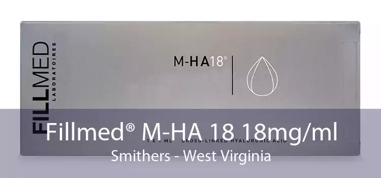 Fillmed® M-HA 18 18mg/ml Smithers - West Virginia