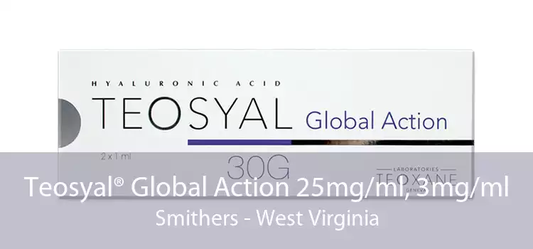 Teosyal® Global Action 25mg/ml, 3mg/ml Smithers - West Virginia